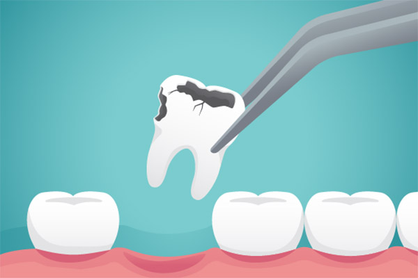 A Periodontist Discusses Possible Consequences From Poor Oral Hygiene