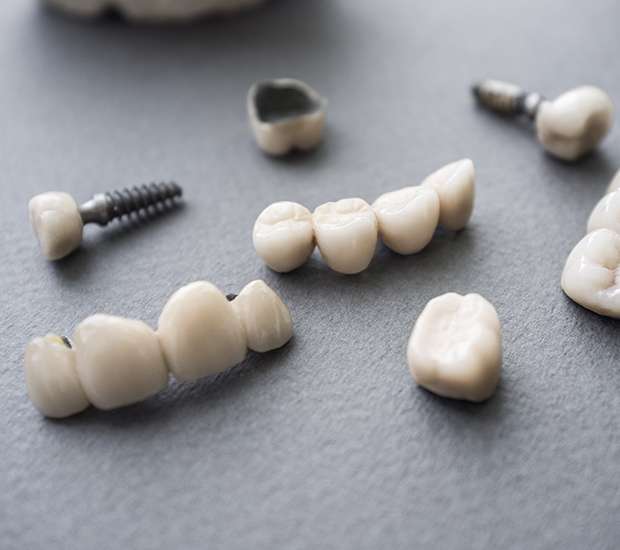 Ventura The Difference Between Dental Implants and Mini Dental Implants