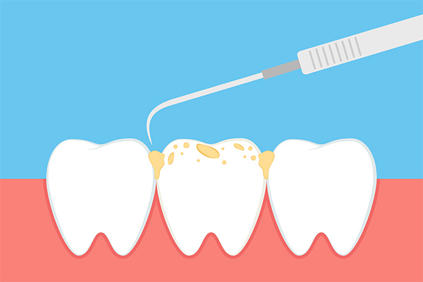 What Your Periodontist Wants You To Know About Plaque And Tartar